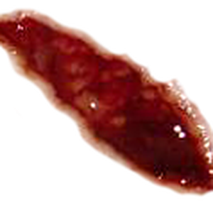 wound PNG image